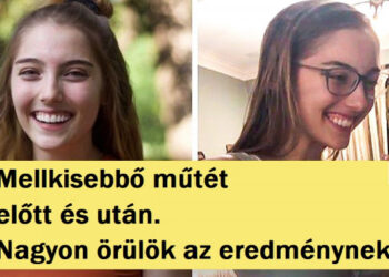 20 előtte és utána fénykép, amik megmutatják, mit jelent a haladás és a kemény munka