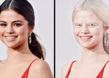 Így nézne ki 15 híresség, ha albínók lennének