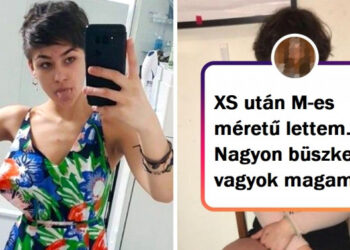 15 személy, akiknek végre sikerült meglátniuk magukban azt a szépséget, amit túl sokáig figyelmen kívül hagytak