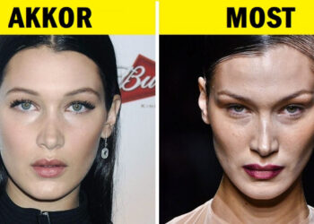 17 sztár, akik úgy döntöttek, hogy búcsút mondanak pufók arcuknak