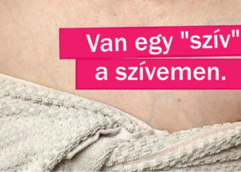 13 emberi test vonás, ami egyedivé teszi a tulajdonosát