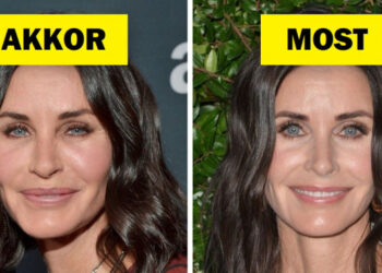 10 sztár osztja meg az okát annak, hogy miért mondtak „nemet” a plasztikai műtétekre, még azok is, akik már feküdtek kés alá