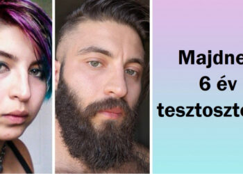 20 kép, mely bemutatja, hogy néz ki a „hatalmas átalakulás”