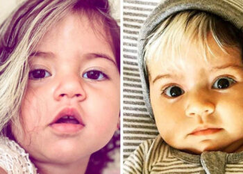 Ez a kislány, aki ősz hajjal született, igazolja, hogy a hibáink még szebbé tesznek bennünket