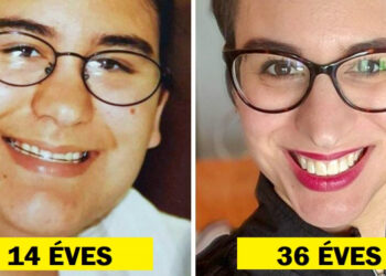 20 személy, aki végigcsinálta a rút kiskacsa fázist, és most a szépségük lélegzetelállító