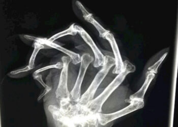 A 24 legfurcsább röntgenképek, amiket életedben láttál