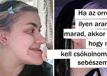 19 személy, aki teljes átalakításon esett át, és csak egyetlen dolgot sajnálnak, hogy csinálták hamarabb