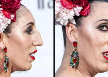 20+ sztár, aki nem akar szépségszalonokba és edzőtermekbe járni, hogy megfeleljen a társadalom szépségügyi normáinak