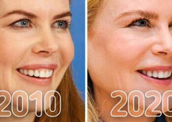 20+ felvétel, mely egyértelműen bemutatja, hogyan változtak meg a hírességek az elmúlt 10 évben