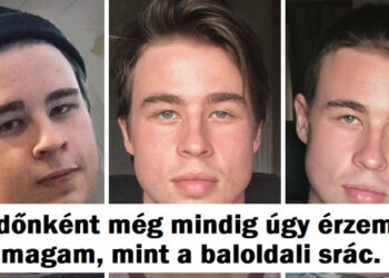 20 személy, aki egy napon más emberként ébredt fel