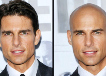 Elképzeltünk 15 sztárt kopaszon, és karizmájuk még magasabb szintet ér el