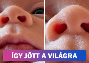 18 alkalom, mikor a természet kreatív volt és az embereket egyedi tulajdonságokkal jutalmazta