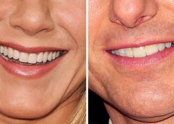 Teszt: Fel tudod ismerni a hírességeket csupán a mosolyuk alapján?