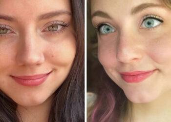 20 személy, akit a természet valami különlegessel ajándékozott meg