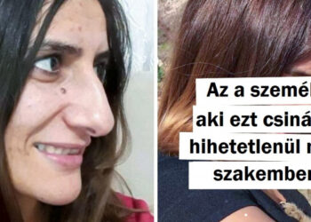 20+ lány, akik úgy döntöttek, hogy plasztikai műtéten esnek át és bizonyították, hogy nincsenek határok, amennyiben a tökéletességről van szó