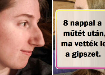 18 előtte-utána fénykép, ami bizonyítja, hogy az apró részletek kijavítása hatalmas különbséget művel