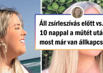 18 személy, akik úgy döntöttek, hogy alávetik magukat plasztikai műtétnek, és soha nem néztek vissza