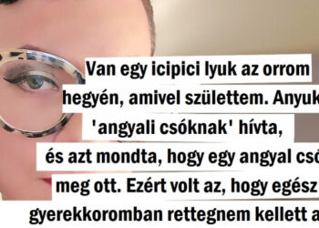 20+ lány, akik végre elfogadták a nem szokványos orrukat és most piszkosul boldogok