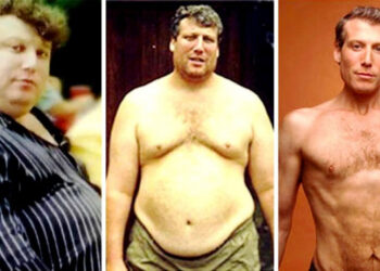 27 személy, aki olyan drasztikusan átalakult, hogy szinte lehetetlen felismerni őket