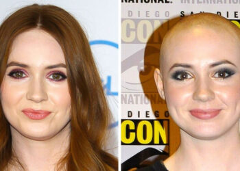 10+ sztár, akik leborotválták a fejüket, és egészen feldobták a megjelenésüket