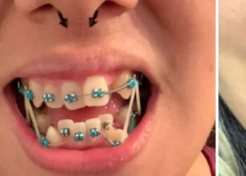 15 felvétel, ami bizonyítja, hogy bárkinek a fogai tökéletes mosollyá varázsolhatók