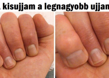 15 emberi test vonás, ami egyedivé teszi a tulajdonosát