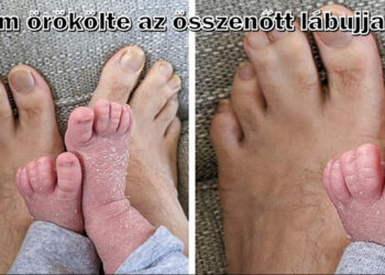 15 fénykép, melyek bizonyítják, hogy különbözni másoktól egy szuperképesség, és ezt meg kell mutatnunk