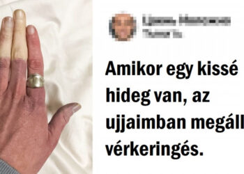 15 személy egyedi megjelenéssel, amit nehéz elfelejteni