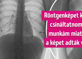 19 dolog, amelyet a természet nem tud megmutatni nekünk, a röntgen viszont igen
