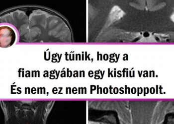 17 dolog, amelyet a természet nem tud megmutatni, de a röntgensugarak igen