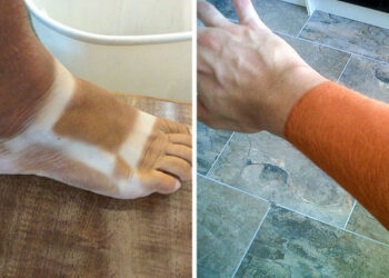 20 felvétel azokról az emberekről, akik túl messzire mentek a barnulással és “rendkívül meg lettek jelölve”