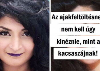 14 ember, aki bevállalt egy plasztikai műtétet, és most boldogan nézik magukat a tükörben