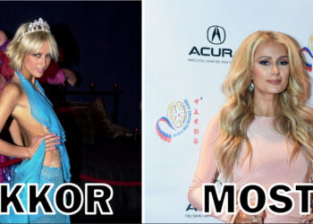 17 sztár, aki abbahagyta a diétát, és még jobban csodáljuk őket