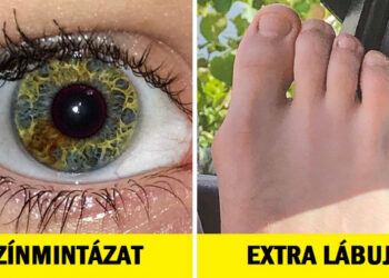 14 személy, akiknek a teste tele van meglepetésekkel, mint egy doboz csokoládé
