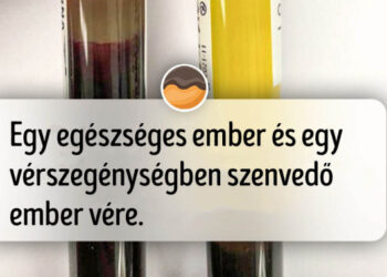 18 összehasonlító kép, mely pillanatok alatt elmagyarázza, amit általában hosszú ideig kell Gugliznunk