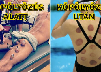 12 kép mutatja a fájdalmat, amelyet az olimpikonoknak el kell viselniük a siker érdekében