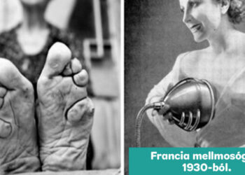 16 furcsa dolog a múltból, amelyet a szépség nevében csináltak magukkal a nők