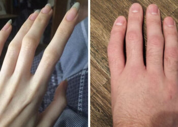 15+ személy, akik elsajátították a különbözőség szabadságát