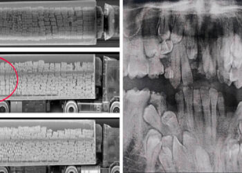 21 fotó, amely a röntgensugarak segítségével szokatlan szemszögből mutatja meg a világot
