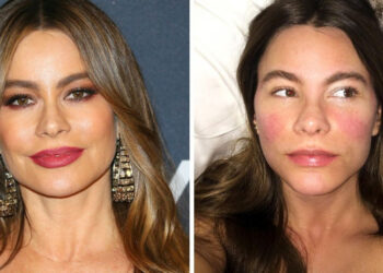 16 sztár, akik nem féltek megmutatni a megjelenésüket smink nélkül