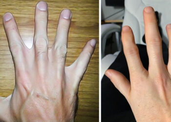 16 fazon, akiknek a testén van egy kis áldás a természettől