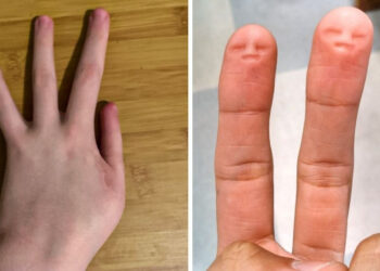 14 ritka testjellemző, melyek különlegessé teszik a tulajdonosaikat