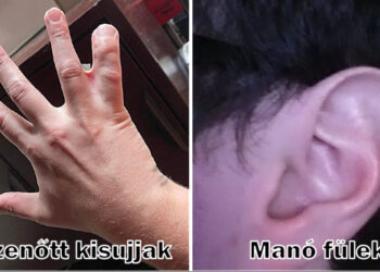 15 személy, akinek a saját teste sosem unja meg, hogy meglepje őket