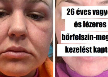 16 személy, akik mertek nagyot változtatni és most nem tudják levenni a szemüket a tükörről
