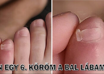 15 személy, aki extra ajándékot kapott az anyatermészettől