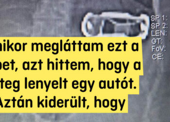 18 hihetetlen röntgenkép, amelyet látva leesik az állad