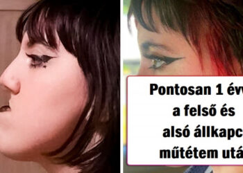 18 személy, akik mertek plasztikai műtétet végeztetni és megütötték a főnyereményt