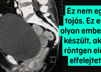 21 lebilincselő röntgenfelvétel, amiről nem fogod tudni levenni a szemedet