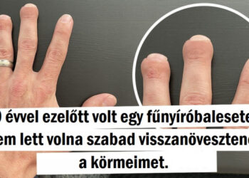 20 fura eset, amikor az életet olyan meglepetésekkel lepett meg, amelyekre senki sem számított