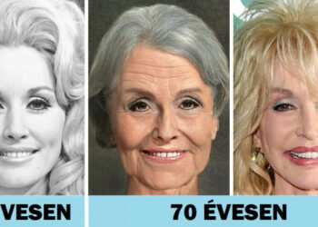 Így nézne ki 14 sztár, amennyiben nem estek volna át plasztikai műtéten